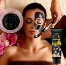 120g Face Mask – Blackhead & Acne Pore Deep Remover for Nose & Face