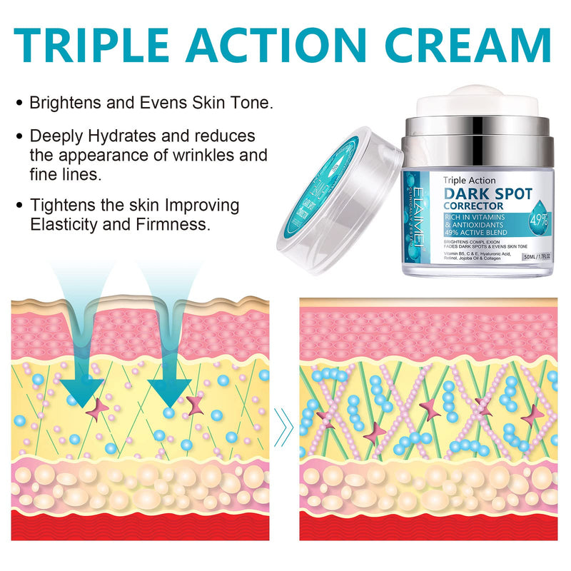 Age Spot Cream | Fades Freckles & Skin Pigmentation | Dark Spot Corrector for Even Skin Tone